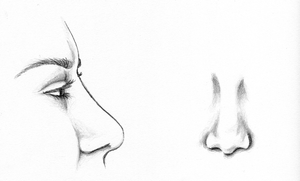 After Revision Rhinoplasty Surgery