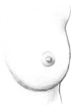 After Fat Transfer to the Breasts Surgery