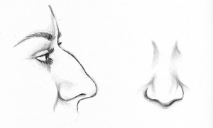 Before Revision Rhinoplasty Surgery